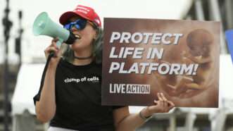 An anti abortion protester yells to protesters in Milwaukee, Wisconsin on Monday, July 15, 2024. The city of Milwaukee is hosting the 2024 Republican Convention which will run from July 15th through July 18th. Photo by Paul Beaty/UPI | PAUL BEATY/UPI/Newscom